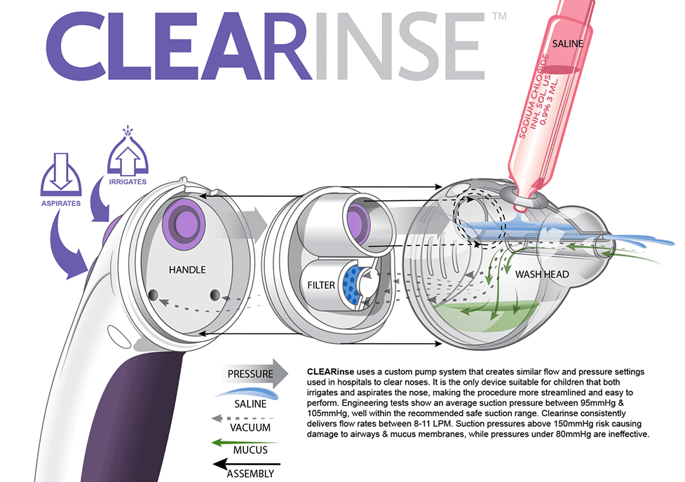 Illustration of the CLEARinse device being used to safely and easily clear nasal passages